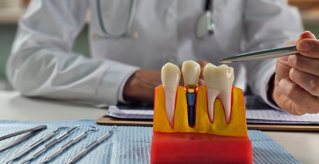 Dental model with tools and doctor