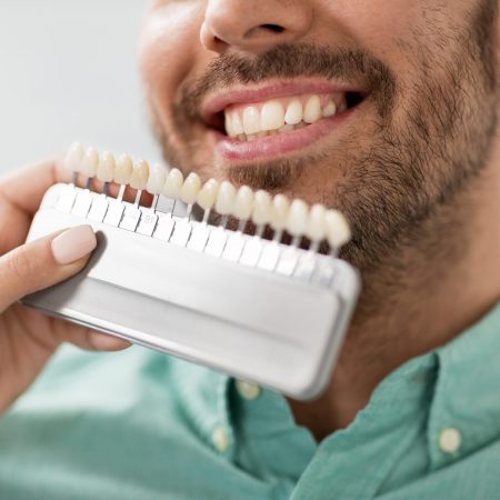 medicine, dentistry and healthcare concept - close up of dentist with tooth color samples choosing shade for male patient teeth at dental clinic