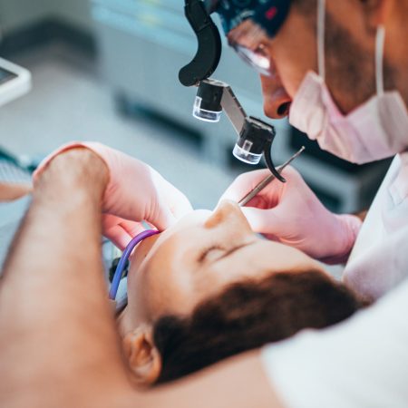 Stages of depulpation - the dentist cleans the dental canal and cauterizes the dental nerve